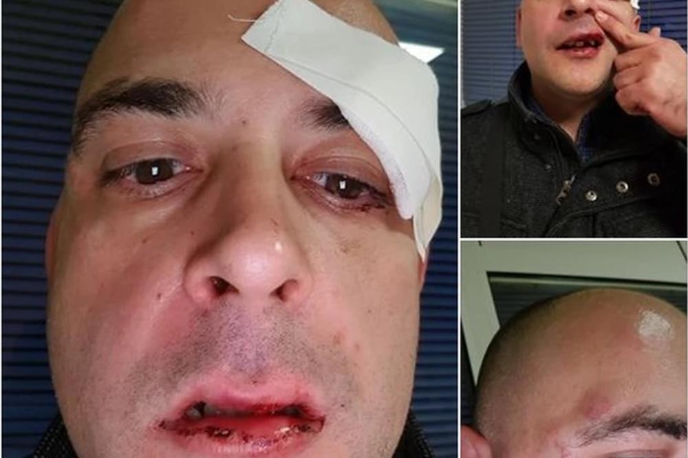 SILEDŽIJE KOJE SU PREBILE ILIJU JER SU MISLILE DA JE GEJ, DOBILE KAZNU: Čekajte da čujete kakvu!