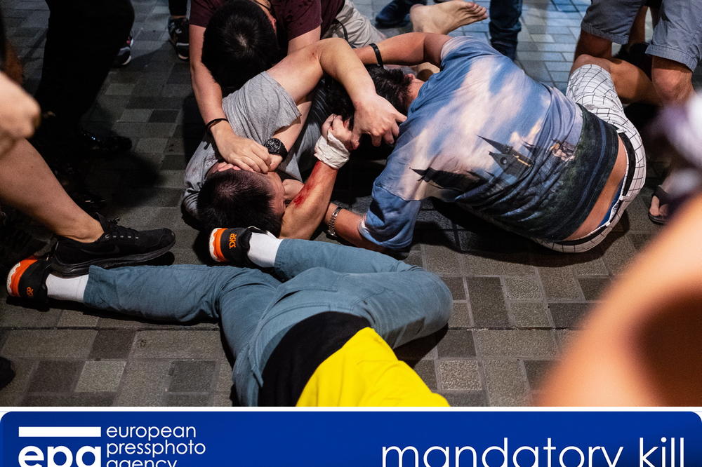 POLITIČARU ODGRIZLI UVO TOKOM SUKOBA! Krv lila na sve strane! Troje ljudi u KRITIČNOM STANJU (VIDEO)