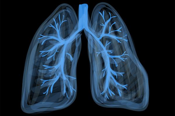 OVI SIMPTOMI NISU BEZAZLENI, UKOLIKO IH OSETITE OBRATITE SE LEKARU: Mogu upozoriti na upalu pluća