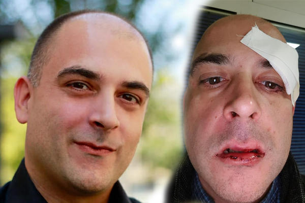 NEOČEKIVAN RASPLET SLUČAJA PREBIJANJA ZBOG LJUBIČASTE TORBE! Oglasio se ILIJA i sve razjasnio!