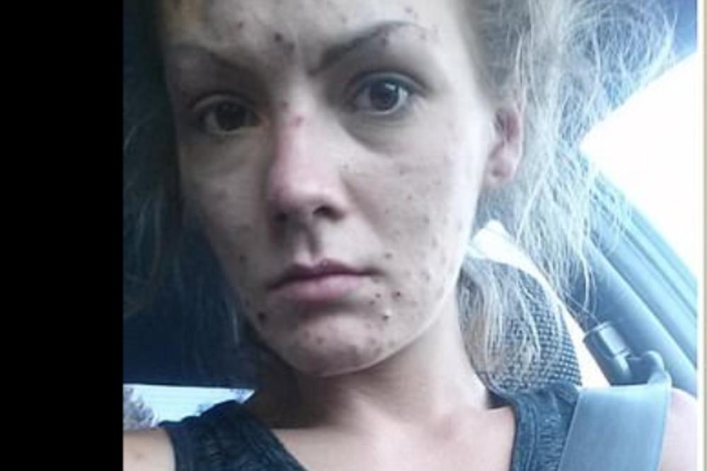 SA 17 GODINA SE NAVUKLA NA HEROIN, ZAVRŠILA U ZATVORU I POKUŠALA DA SE UBIJE: Njena TRANSFORMACIJA će vas zadiviti!