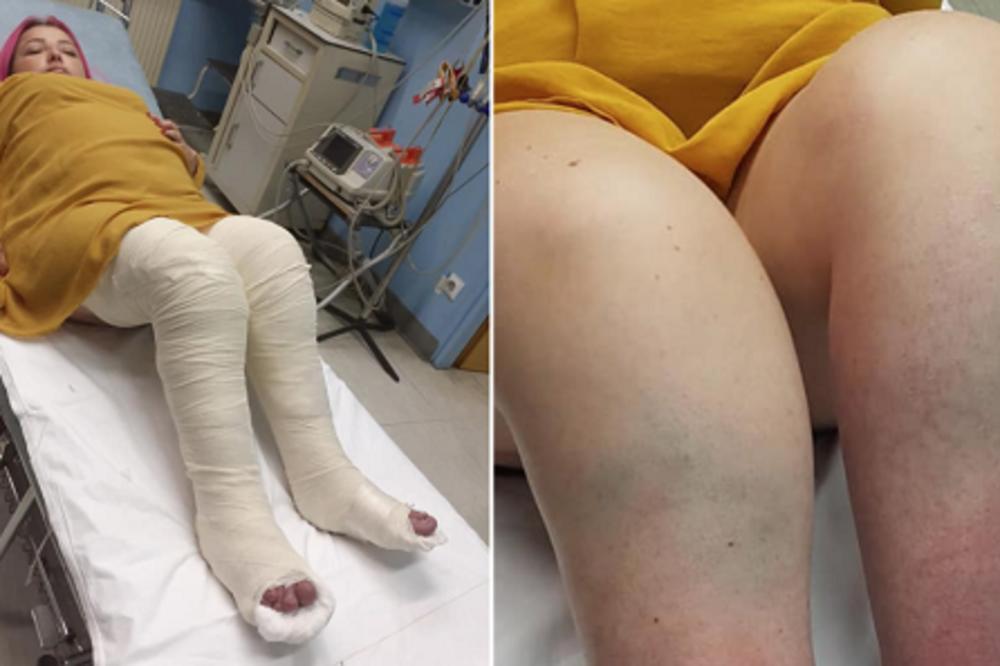 JELENA IZ KRALJEVA JE ISPALA IZ INVALIDSKIH KOLICA: Polomila je obe potkolenice, a razlog će vas RAZBESNETI!