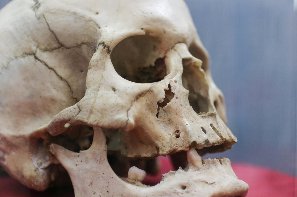 IDENTIFIKOVAN NULTI PACIJENT OD PRE PREKO 5.000 GODINA: Muškarac iz LETONIJE najstarija žrtva KUGE!