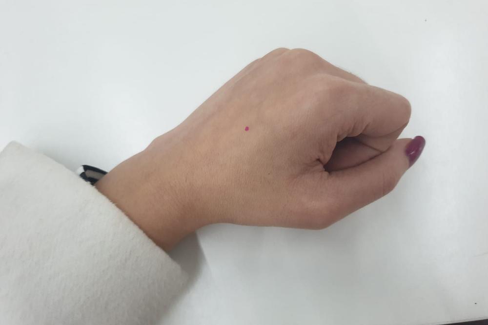 KONAČNO OTKRIVENO KOLIKO DUGO KORONA OSTAJE NA KOŽI: Zna se i čime može potpuno da se uništi!