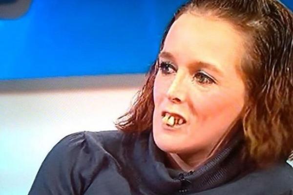 RUGALI SU JOJ SE I ZVALI JE ŽENA SA KONJSKIM ZUBIMA! Ona je sada uradila nešto DRASTIČNO, izgleda još ČUDNIJE!