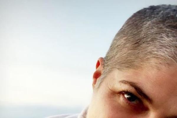 POZNATA GLUMICA BOLUJE OD NEIZLEČIVE BOLESTI: Htela sam da se ofarbam u crno, a dobila sam SMEĐU NA SAMRTI (FOTO)