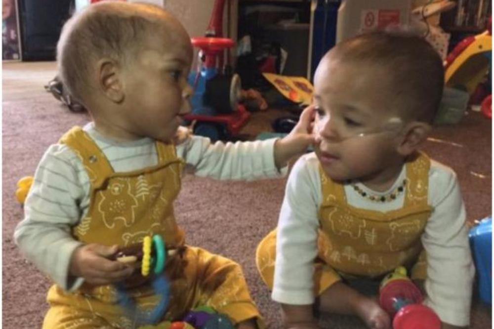 DOKTORI SU PREDVIĐALI SMRT BEBI ROĐENOJ PRE VREMENA: Brat ga je dodirnuo i lekari ne mogu da objasne kako je živ!