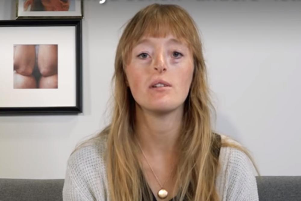 PROGLASILI SU JE NAJRUŽNIJOM DEVOJKOM NA SVETU! Onda im je poslala poruku kojom je svima zapušila usta!