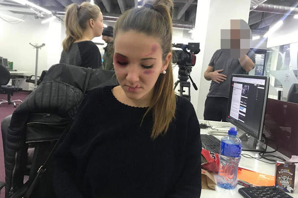 NOVINARKA ESPRESA PRETUČENA U CENTRU BEOGRADA! Pisala je o zlostavljanju gej populacije (FOTO)