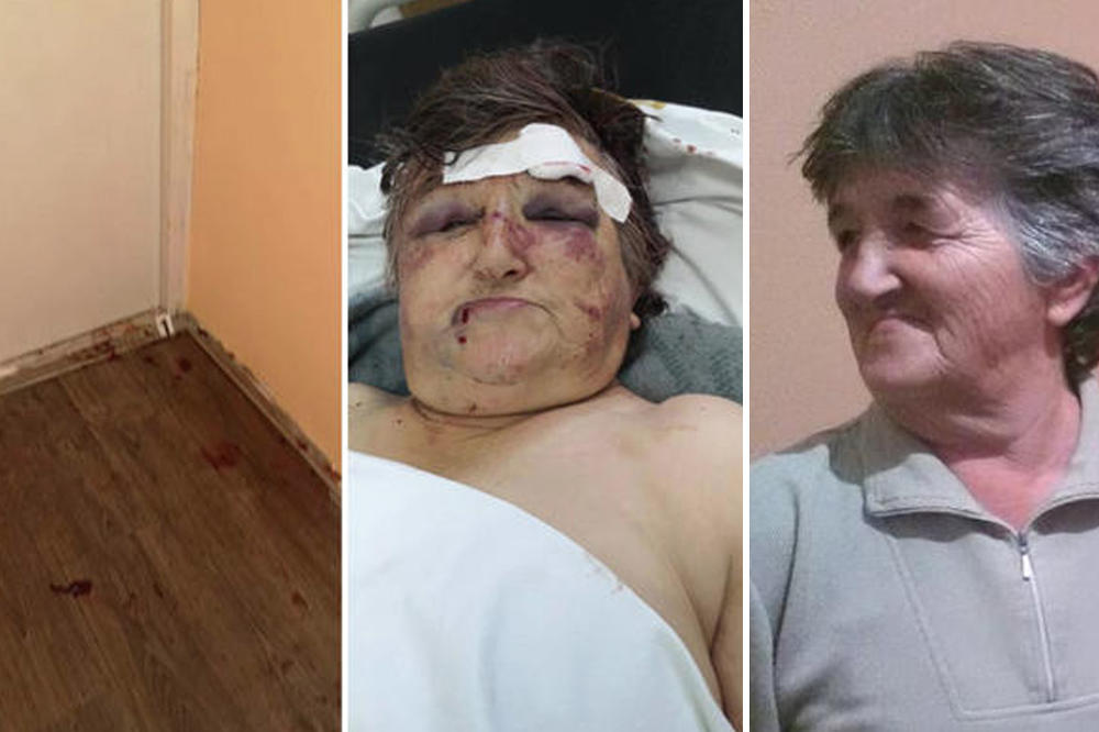 ŠAPČANKA (73) JE ZVERSKI PRETUČENA! Slobodan joj je glavu LUPAO O ZID, policija je NEMOĆNA (FOTO)