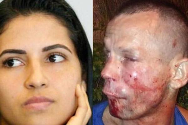 PLJAČKAŠ NAPAO MMA LEPOTICU I NAPRAVIO ŽIVOTNU GREŠKU: Zanosna devojka mu unakazila lice za ceo život!(FOTO)