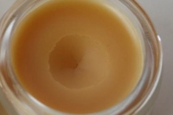 ULJE NIKAKO NEMOJTE VIŠE DA KORISTITE, 1 VRSTA MASTI JE NAJZDRAVIJA: Doktor UPOZORIO zašto OVO MORATE DA IZBEGAVATE