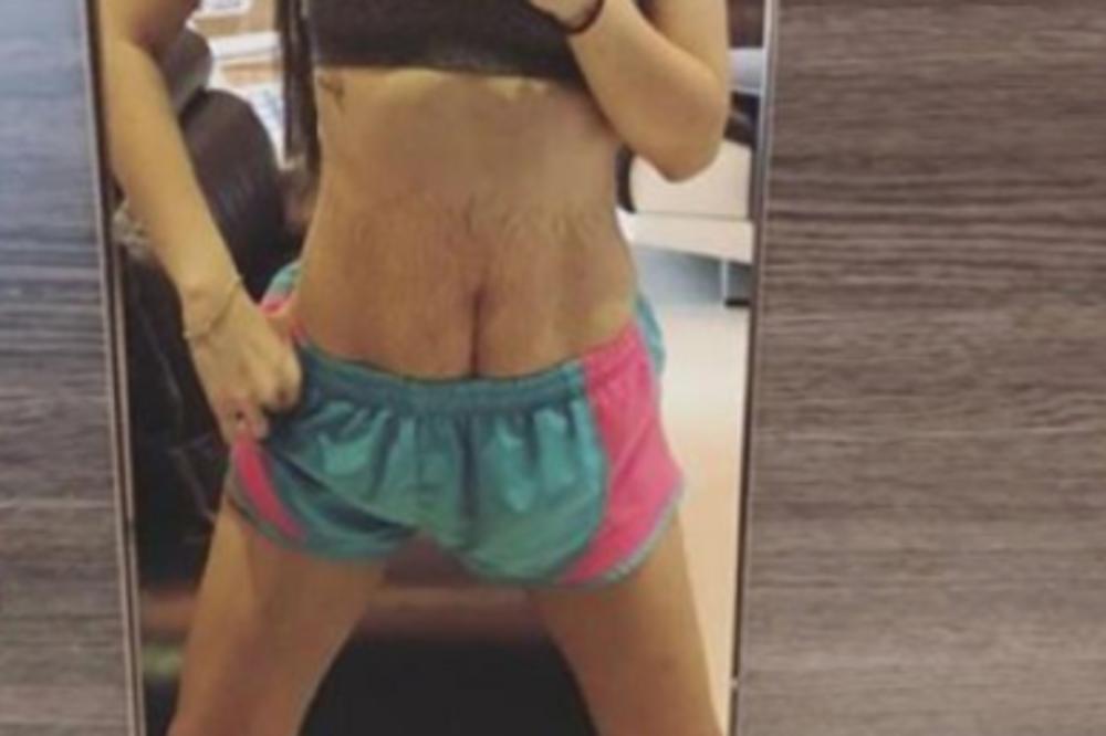 SRBIJOM ODJEKNULA VEST: Poznatu blogerku NAPALI POSLE POROĐAJA! Zbog celog SKANDALA pokazala svoj UNAKAŽENI STOMAK!