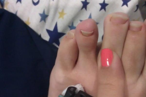 ODMAH SKINITE ČARAPE I POGLEDAJTE: Ako vam je DRUGI prst duži od svih ostalih, onda OVO morate da znate!