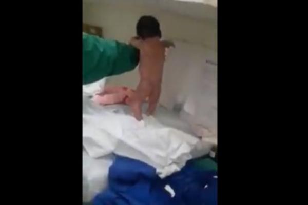 BEBA PROHODALA NEKOLIKO MINUTA NAKON ROĐENJA: Doktori nisu mogli da dođu sebi posle ove LUDAČKE SCENE! (VIDEO)