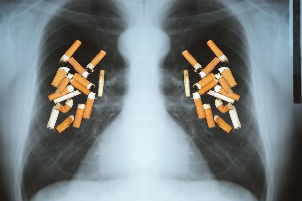 Naučnici utvrdili zašto neki pušači NE OBOLE od raka pluća, ovome se nisu nadali!