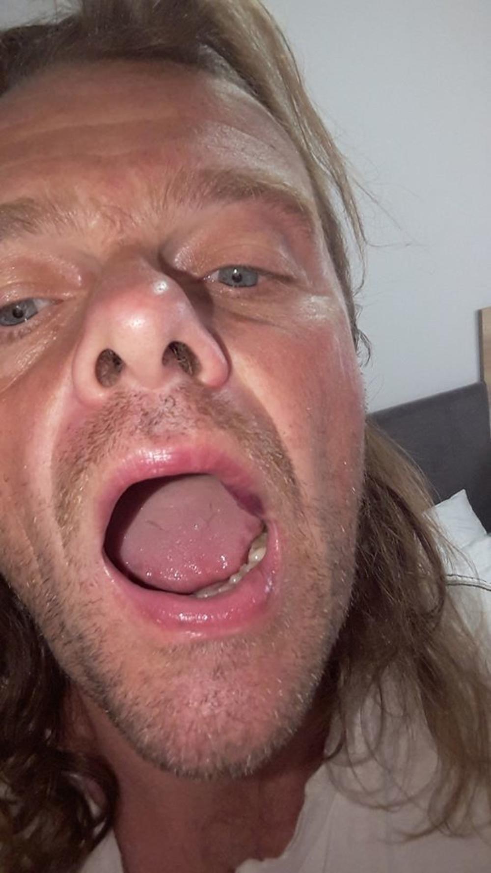 Dušan je imao i natečenu usnu od udarca