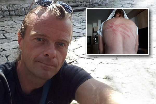 PUN MI JE KU*AC VAS IZ BEOGRADA, SAD ĆEŠ DA VIDIŠ KO SAM! Dušan tvrdi da ga je POLICAJAC šibao PENDREKOM IZ ZABAVE