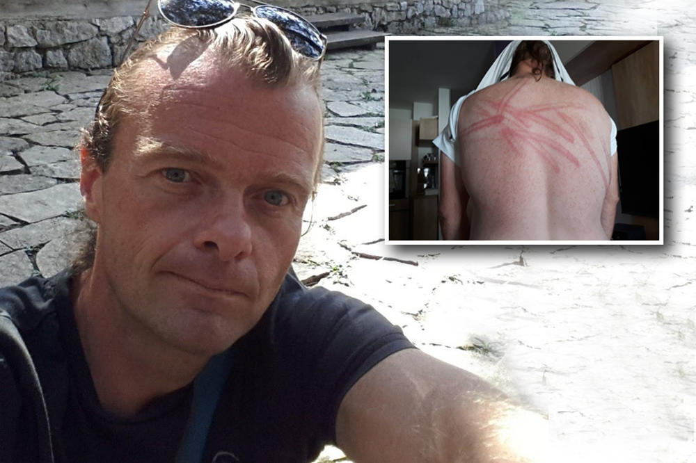 PUN MI JE KU*AC VAS IZ BEOGRADA, SAD ĆEŠ DA VIDIŠ KO SAM! Dušan tvrdi da ga je POLICAJAC šibao PENDREKOM IZ ZABAVE