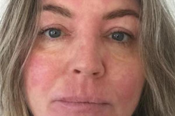 OVA ŽENA JE DOŽIVELA PAKAO ZBOG NOVOGODIŠNJE JELKE: Njeno upozorenje moraju svi da pročitaju! (FOTO)