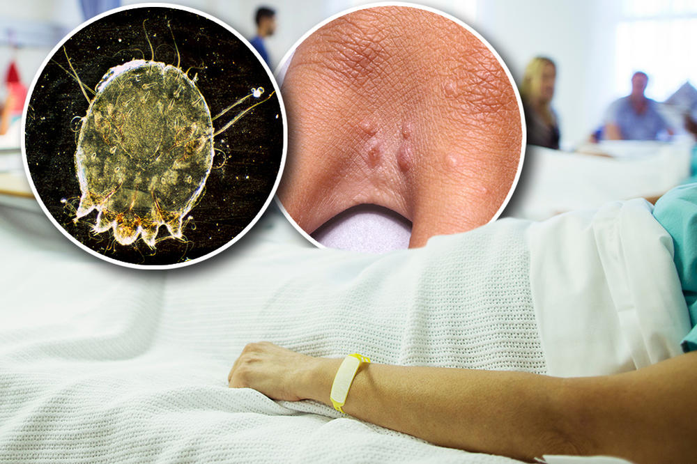 NALOŽENE MERE BEOGRADSKOJ ŠKOLI U KOJOJ SE POJAVILA ŠUGA: Zaražen 1 UČENIK, roditelji ZABRINUTI!