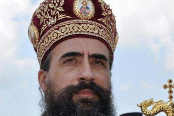 IMA UNUTRAŠNJE KRVARENJE: Pogledajte slike vladike Metodija nakon brutalnog prebijanja od strane policije (FOTO)