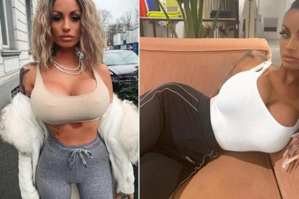 U NJU SVI GLEDAJU: Operisala grudi čak četiri puta, u njih je uložila 20.000 EVRA