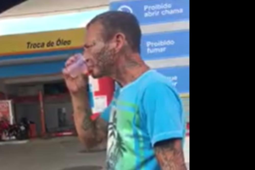 POSLEDNJI STADIJUM ALKOHOLIZMA! Kada vidite šta je ovaj čovek popio, zgadiće vam se život! (VIDEO)