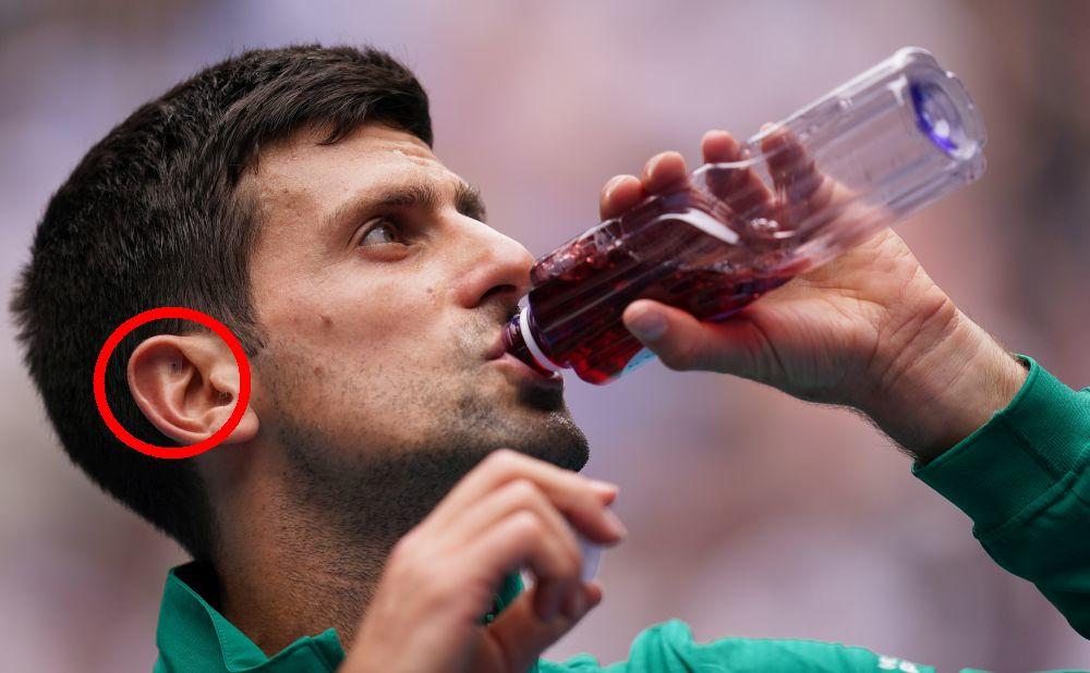 Novak odavno već praktikuje akupunkturu