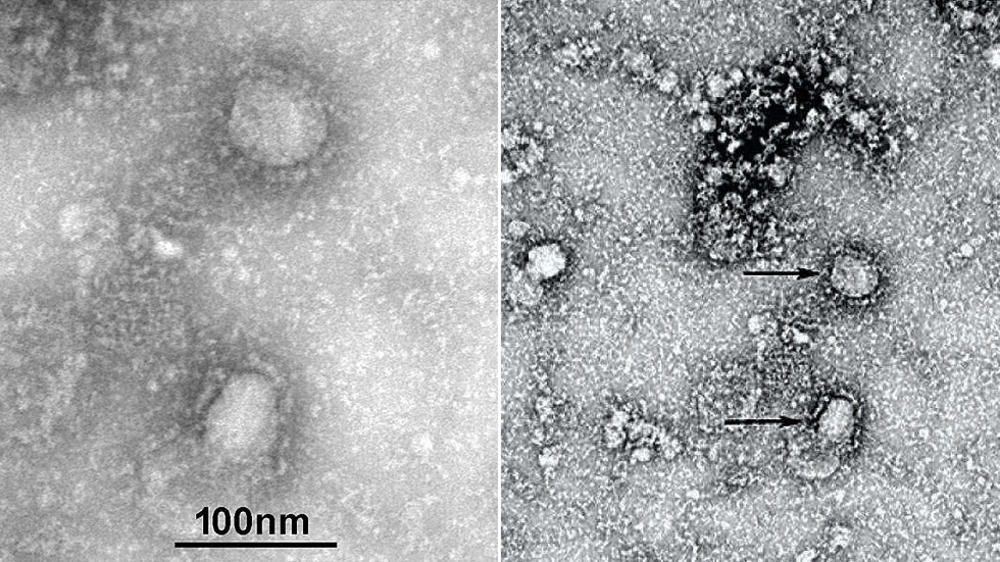 Koronavirus pod mikroskopom 