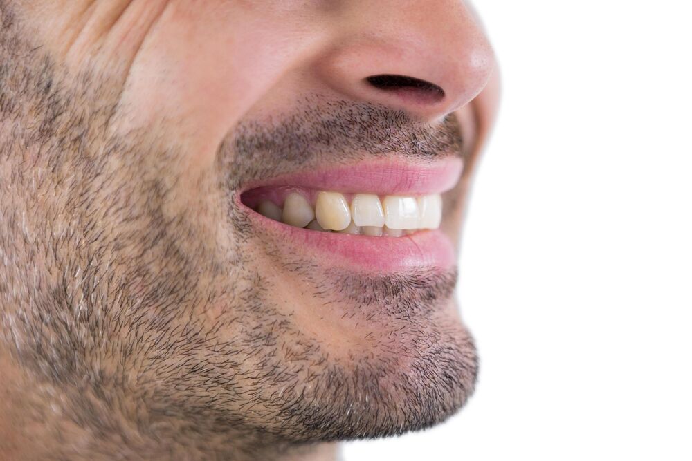 Zubi, Muškarac, Osmeh, Žuti zubi