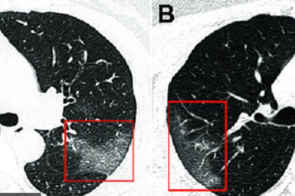 NAJNOVIJA VEST: Sedam osoba TESTIRANO NA KORONAVIRUS u Srbiji, stigli su REZULTATI!