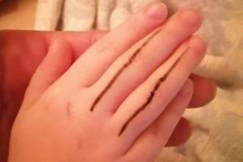 NACRTAJTE DETETU CRNIM FLOMASTEROM LINIJE: Je l moguće da je LEKARKA savetovala ženi da ovo uradi? (FOTO)