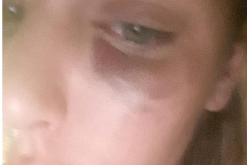 BRUTALNO PRETUČENA AVA KARABATIĆ! KRV NA SVE STRANE, JEZIVE SCENE ULIVAJU STRAH U KOSTI