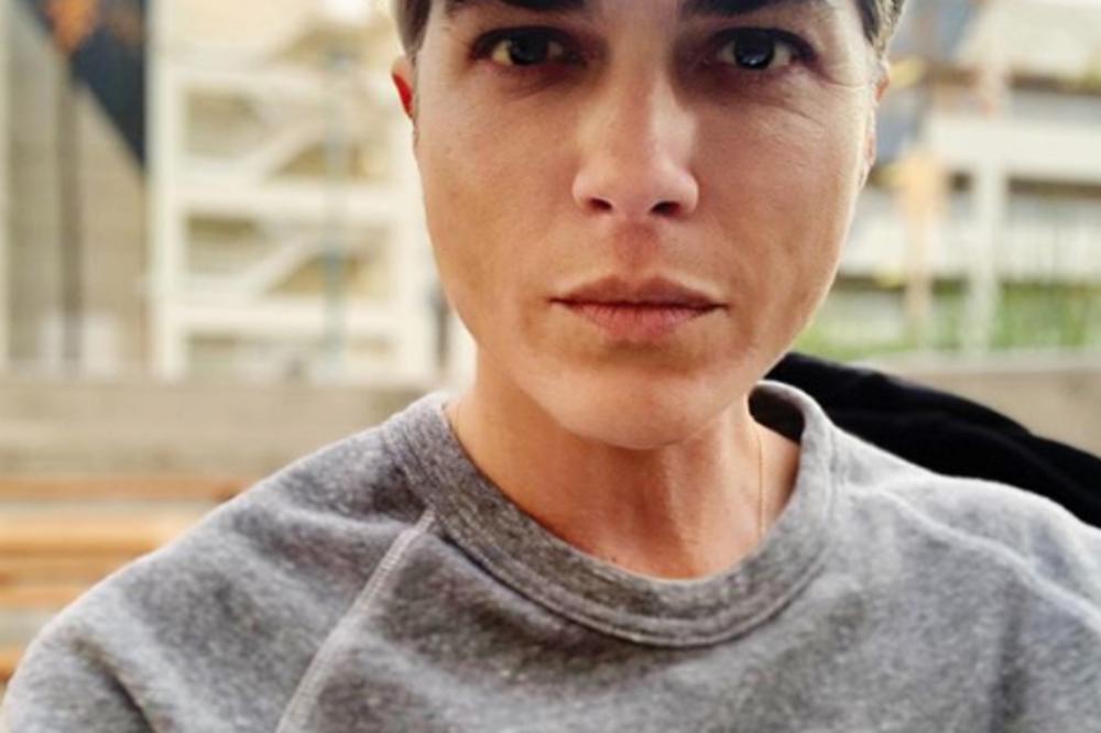 GLUMICA SE BORI SA STRAŠNOM BOLEŠĆU, A SADA JE OBJAVILA SLIKU ZBOG KOJE SVI PLAČU: Osećam se jadno, bojim se...