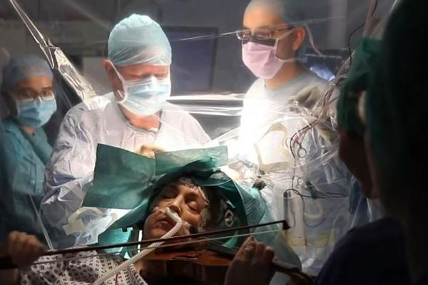 SVIRALA VIOLINU DOK SU JOJ OPERISALI MOZAK: Scena za pamćenje iz operacione sale! Evo zašto su lekari to dozvolili