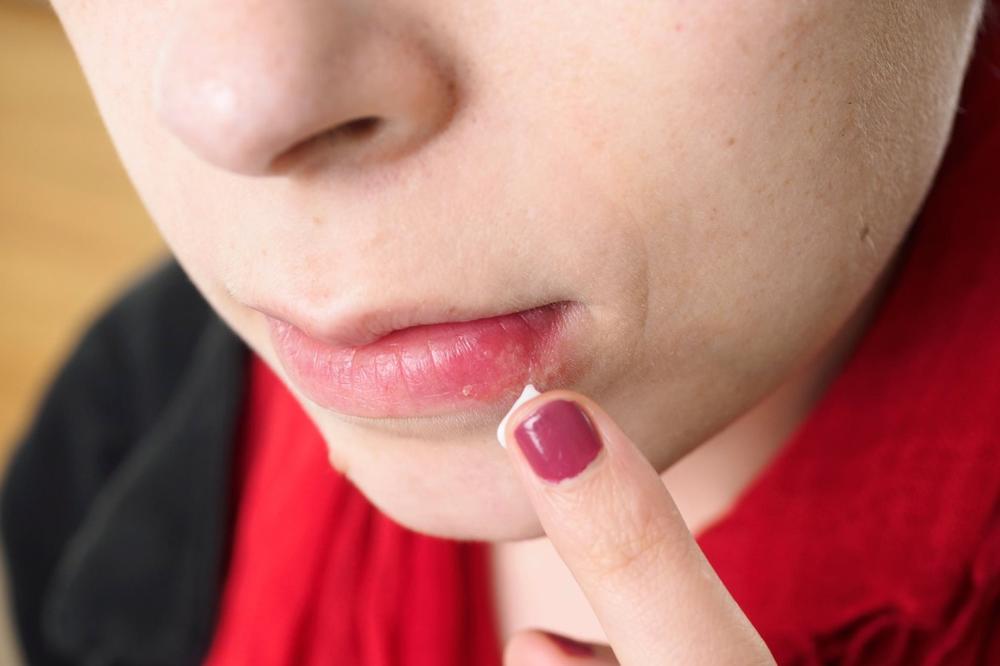 SUVA USTA MOGU BITI SIMPTOM OZBILJNE BOLESTI: U OVOM slučaju je poseta lekaru NEOPHODNA