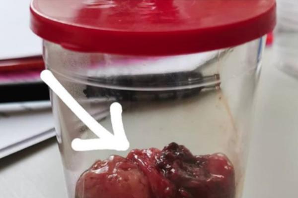 BAKA PRASE SVE SNIMA ZA JUTJUB, TAKO I SVOJE KRAJNIKE: Krvavi, u čašici, čuva ih zauvek a LJUDI SE GROZE NA PRIZOR!