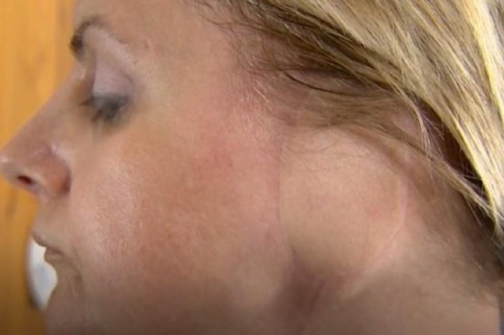 IZGUBILA UVO ZBOG NEČEG ŠTO KORISTE I MNOGE DEVOJKE U SRBIJI! O slici ove žene priča CEO SVET! (FOTO)