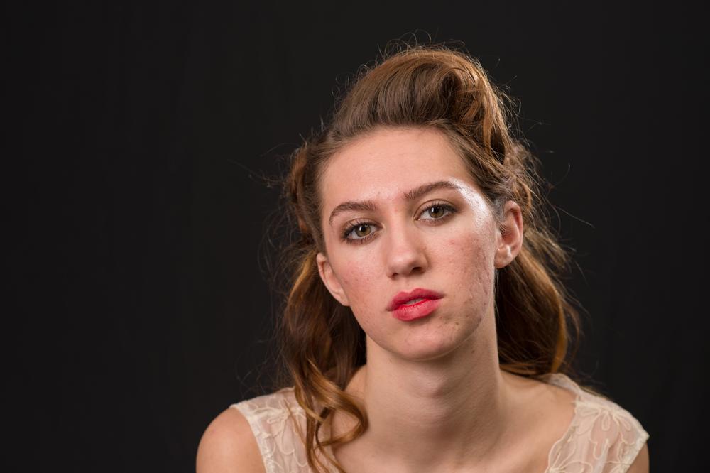 SAZNAJTE KOJI SU SIMPTOMI POLICISTIČNIH JAJNIKA: Rešite tegobe na vreme na ovaj potpuno prirodan način!