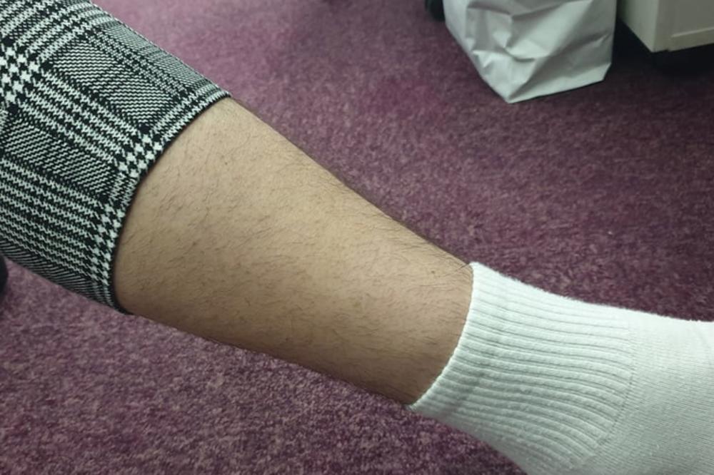 URASLE DLAKE MOGU DA DOVEDU DO SMRTONOSNIH POSLEDICA? Ako uočite ove simptome primetite, OBAVEZNO posetite lekara