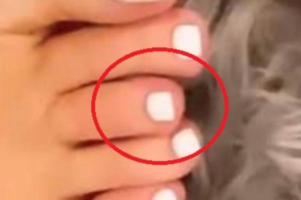 ODMAH SKINITE ČARAPE I POGLEDAJTE: Ako vam je DRUGI prst duži od svih ostalih, TO NIJE ZA DŽABE!