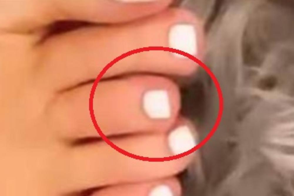 CEO SVET PRIČA O PRSTU NA STOPALU KAJLI DŽENER! Šta se to desilo??? (FOTO)