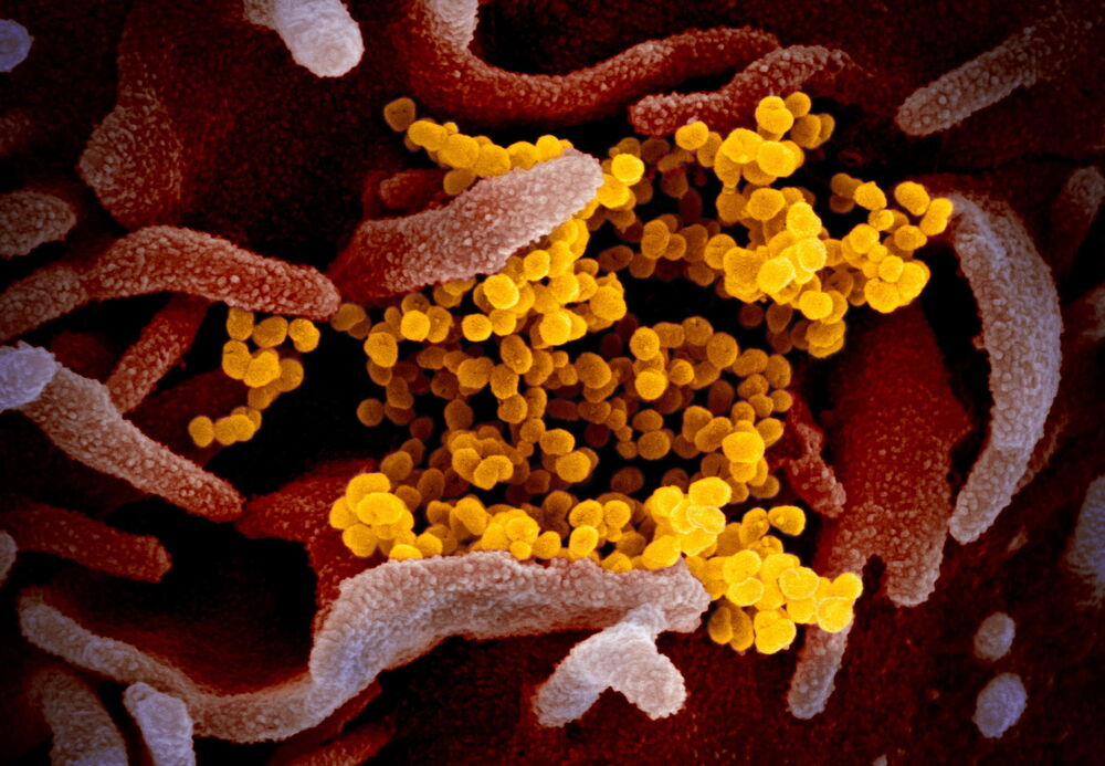 Virus