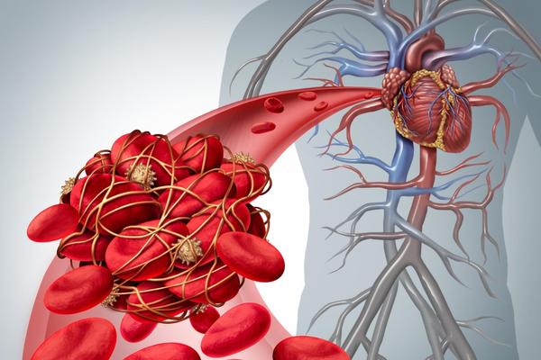 OVIH 10 NAMIRNICA POMAŽE KOD SNIŽAVANJA HOLESTEROLA I SPUŠTAJU KRVNI PRITISAK: Održavaju vaše krvne sudove ZDRAVIM
