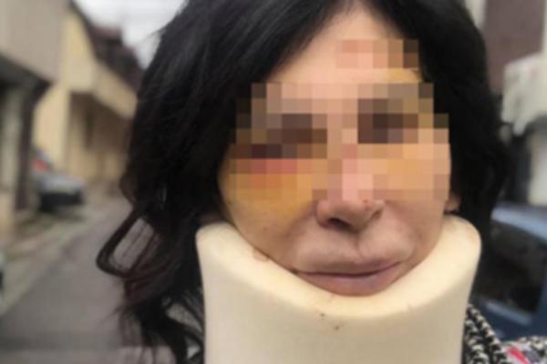 OVO JE SRPSKA STRIPTIZETA KOJA JE BRUTALNO PRETUČENA U SLOVENIJI Albanac je BESOMUČNO UDARAO, pa HTEO DA JE zadavi!