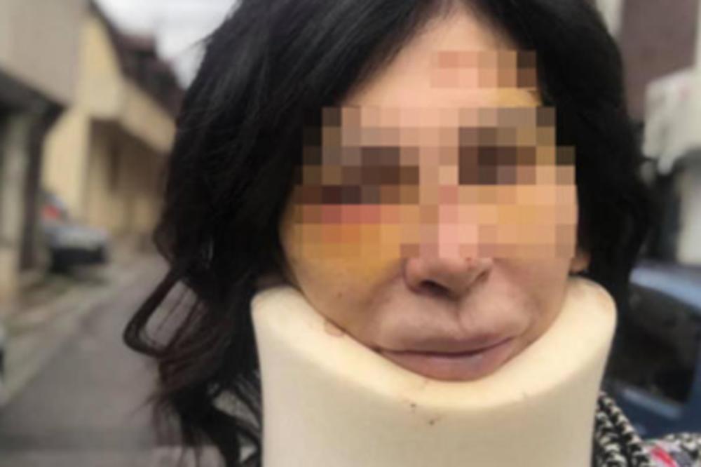 OVO JE SRPSKA STRIPTIZETA KOJA JE BRUTALNO PRETUČENA U SLOVENIJI Albanac je BESOMUČNO UDARAO, pa HTEO DA JE zadavi!