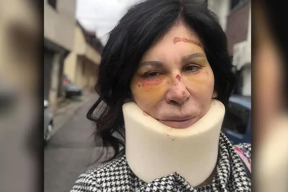 SAMO JE SMRT OD MENE JAČA! Ispovest STRIPTIZETE koju su prebio Albanac, TRPI STRAŠNE BOLOVE!