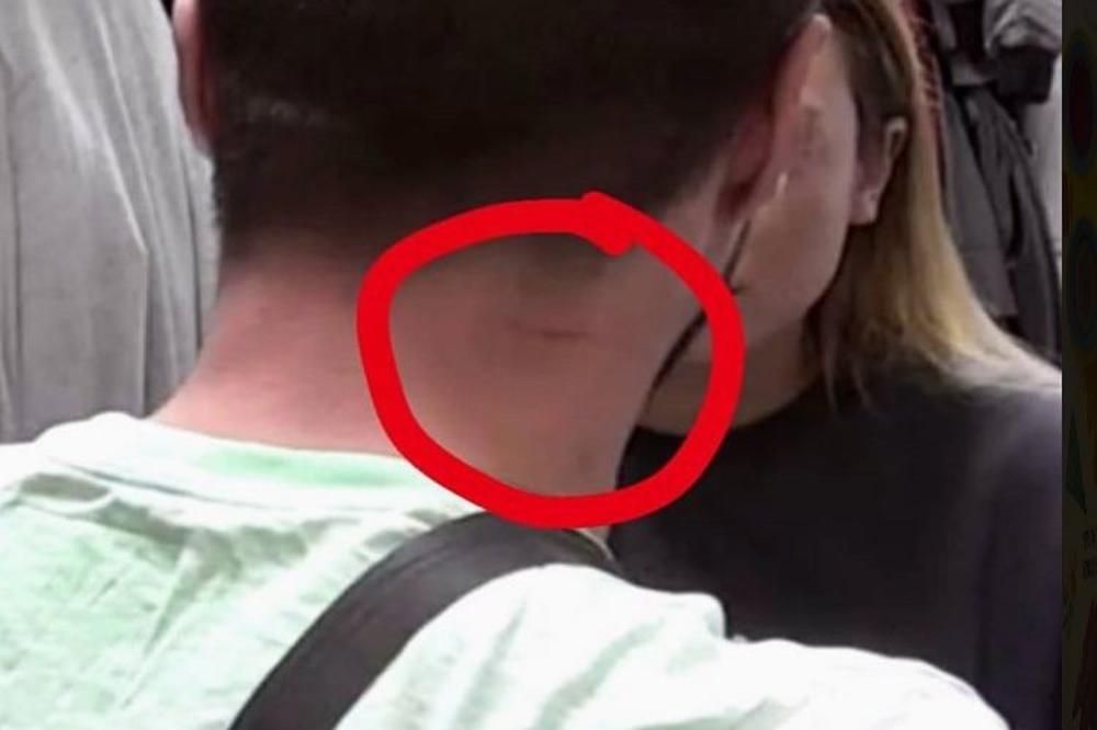 Ponovo je agresivna! Anabela Marka davila i udarala po glavi! (VIDEO)