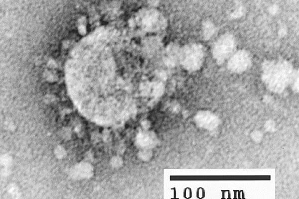 NAUČNICI OTKRILI, KORONAVIRUS MUTIRA, IMA ČAK 8 SOJEVA! Ovo su svi detalji!